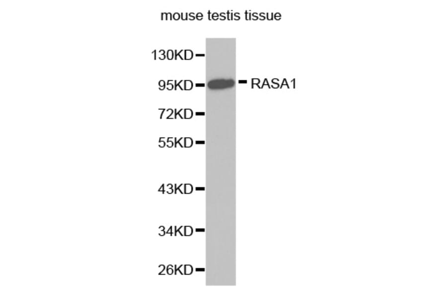 Western blot - RASA1 antibody from Signalway Antibody (38272) - Antibodies.com
