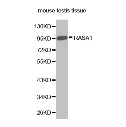 Western blot - RASA1 antibody from Signalway Antibody (38272) - Antibodies.com