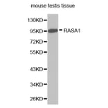 Western blot - RASA1 antibody from Signalway Antibody (38272) - Antibodies.com