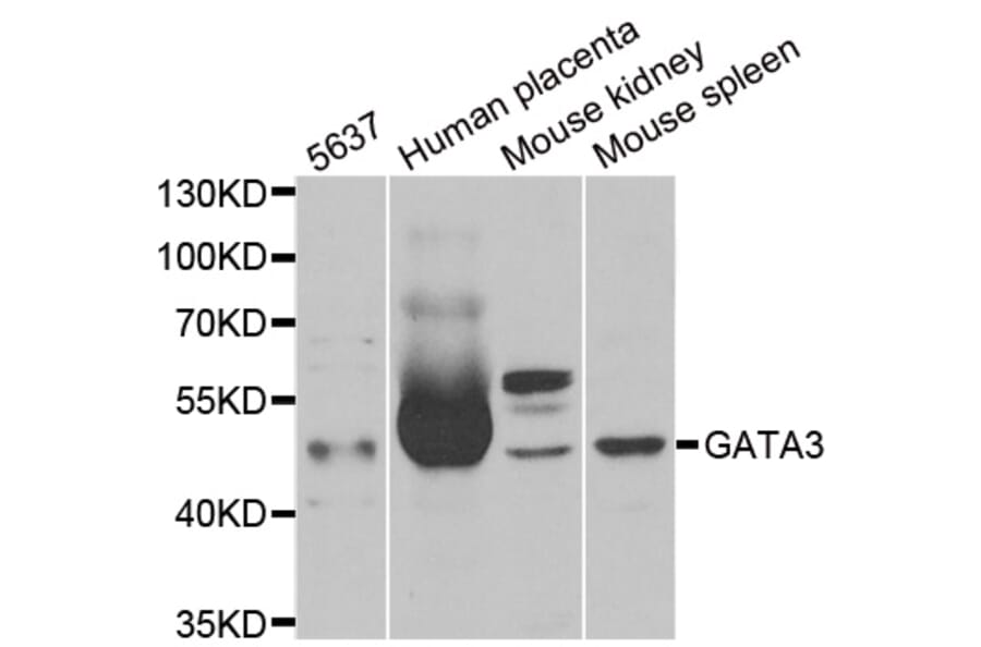 Western blot - GATA3 antibody from Signalway Antibody (38273) - Antibodies.com