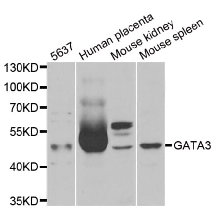 Western blot - GATA3 antibody from Signalway Antibody (38273) - Antibodies.com