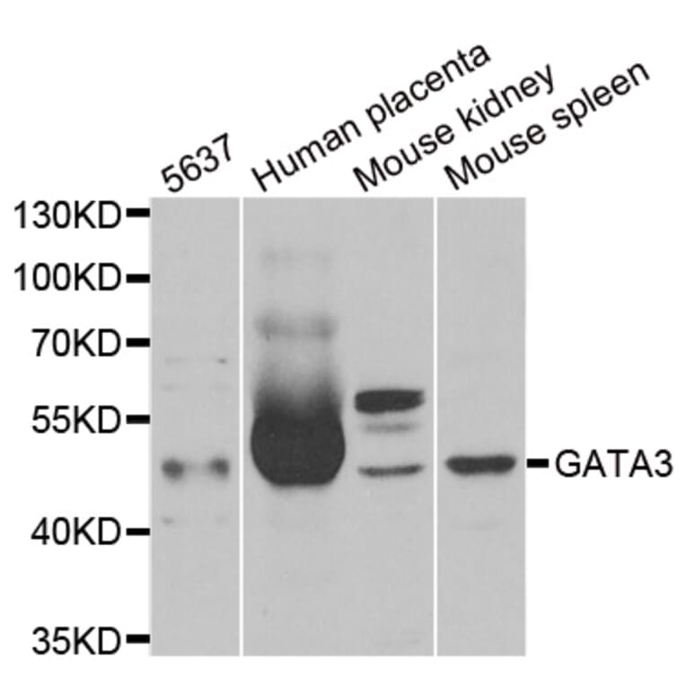 Western blot - GATA3 antibody from Signalway Antibody (38273) - Antibodies.com