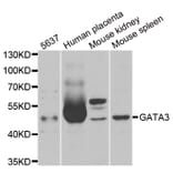 Western blot - GATA3 antibody from Signalway Antibody (38273) - Antibodies.com