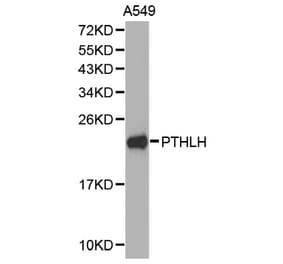 Western blot - PTHLH antibody from Signalway Antibody (38274) - Antibodies.com