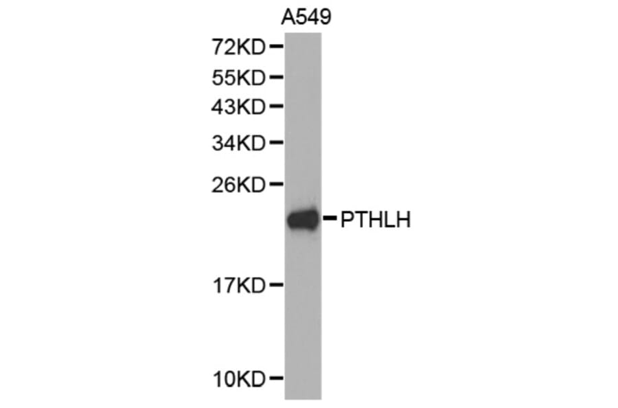 Western blot - PTHLH antibody from Signalway Antibody (38274) - Antibodies.com