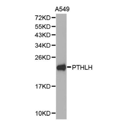 Western blot - PTHLH antibody from Signalway Antibody (38274) - Antibodies.com