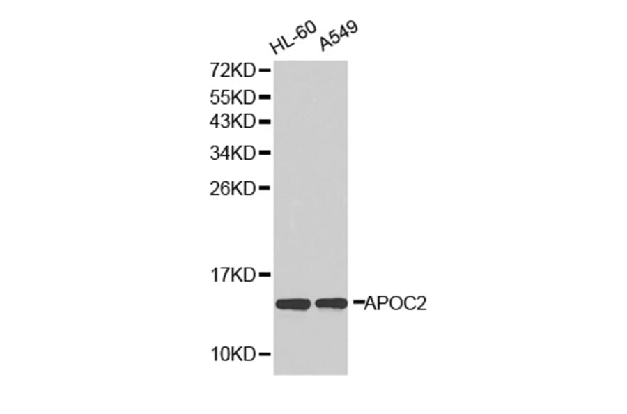 Western blot - APOC2 antibody from Signalway Antibody (38294) - Antibodies.com