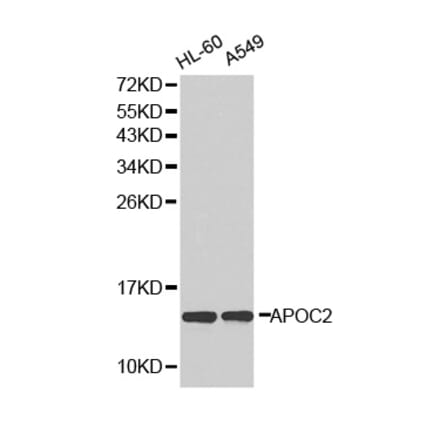 Western blot - APOC2 antibody from Signalway Antibody (38294) - Antibodies.com