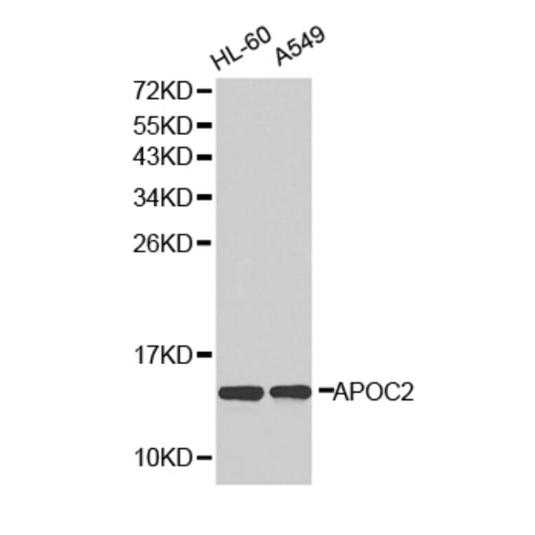 Western blot - APOC2 antibody from Signalway Antibody (38294) - Antibodies.com