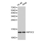 Western blot - APOC2 antibody from Signalway Antibody (38294) - Antibodies.com