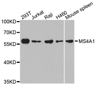 Western blot analysis of extracts of various cell lines, using MS4A1 antibody.