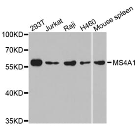 Western blot - MS4A1 antibody from Signalway Antibody (38300) - Antibodies.com