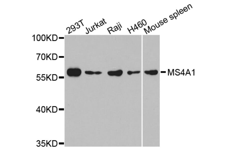 Western blot - MS4A1 antibody from Signalway Antibody (38300) - Antibodies.com