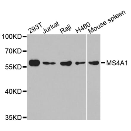 Western blot - MS4A1 antibody from Signalway Antibody (38300) - Antibodies.com