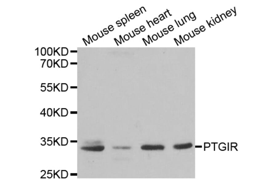 Western blot - PTGIR antibody from Signalway Antibody (38310) - Antibodies.com