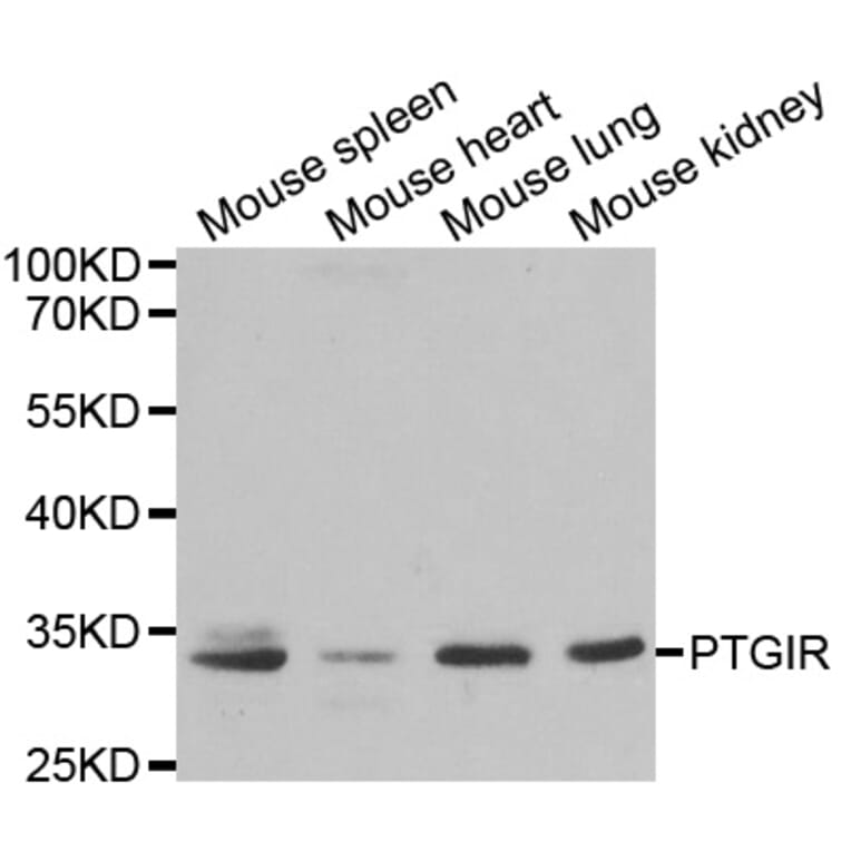 Western blot - PTGIR antibody from Signalway Antibody (38310) - Antibodies.com