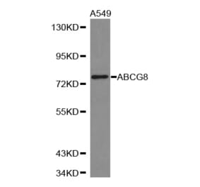 Western blot - ABCG8 antibody from Signalway Antibody (38312) - Antibodies.com