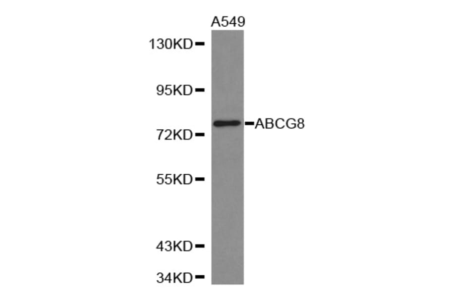 Western blot - ABCG8 antibody from Signalway Antibody (38312) - Antibodies.com