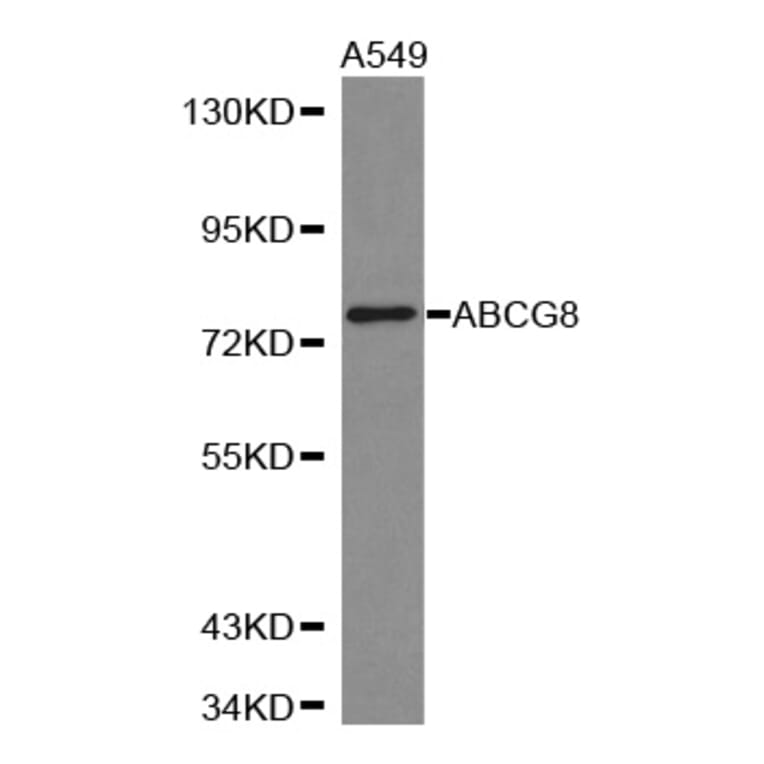 Western blot - ABCG8 antibody from Signalway Antibody (38312) - Antibodies.com