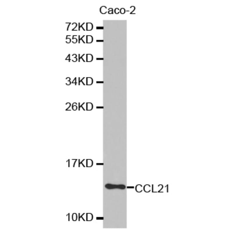 Western blot - CCL21 antibody from Signalway Antibody (38315) - Antibodies.com