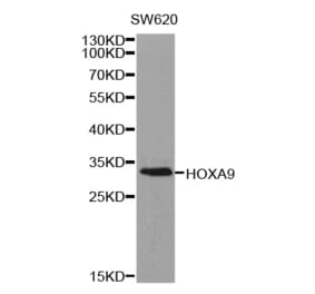 Western blot - HOXA9 antibody from Signalway Antibody (38317) - Antibodies.com