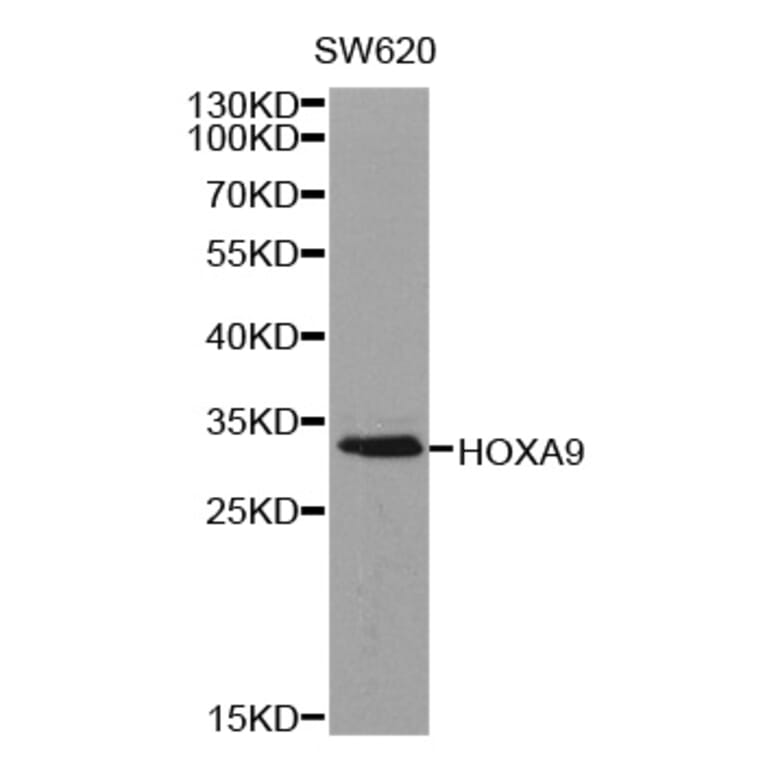 Western blot - HOXA9 antibody from Signalway Antibody (38317) - Antibodies.com