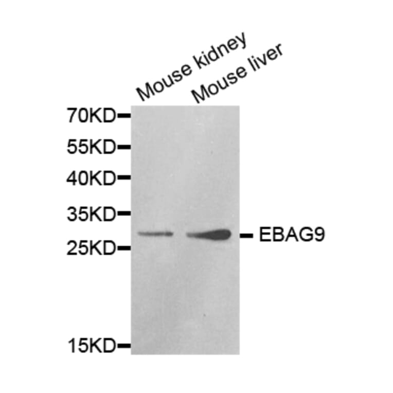 Western blot - EBAG9 antibody from Signalway Antibody (38323) - Antibodies.com