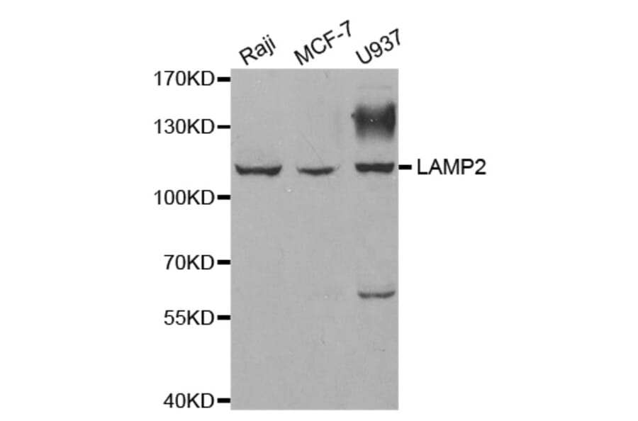 Western blot - LAMP2 antibody from Signalway Antibody (38326) - Antibodies.com