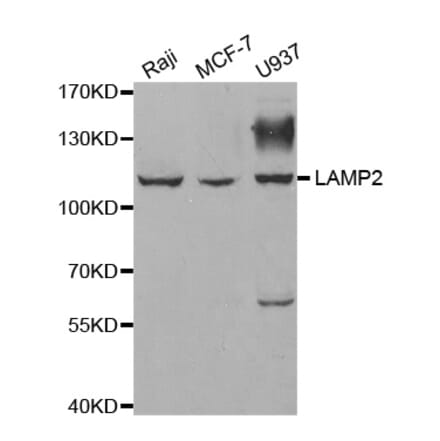 Western blot - LAMP2 antibody from Signalway Antibody (38326) - Antibodies.com