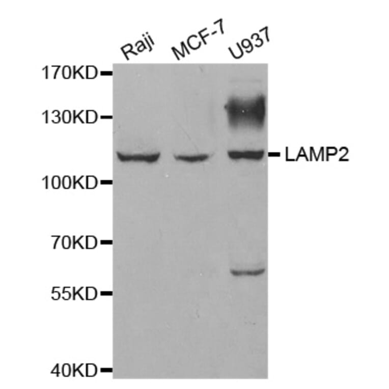 Western blot - LAMP2 antibody from Signalway Antibody (38326) - Antibodies.com