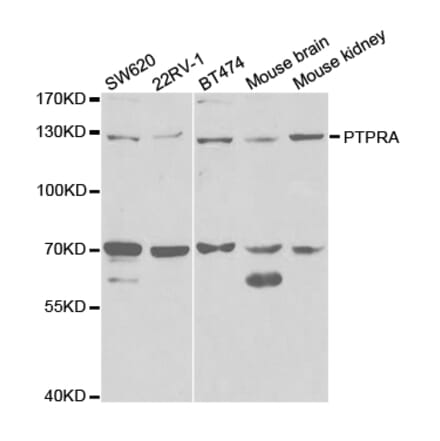 Western blot - PTPRA antibody from Signalway Antibody (38329) - Antibodies.com