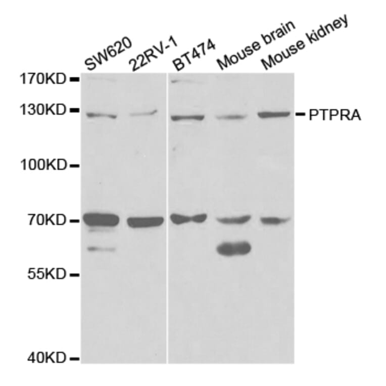 Western blot - PTPRA antibody from Signalway Antibody (38329) - Antibodies.com