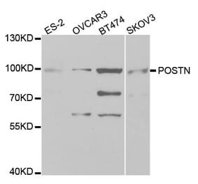 Western blot - POSTN antibody from Signalway Antibody (38331) - Antibodies.com