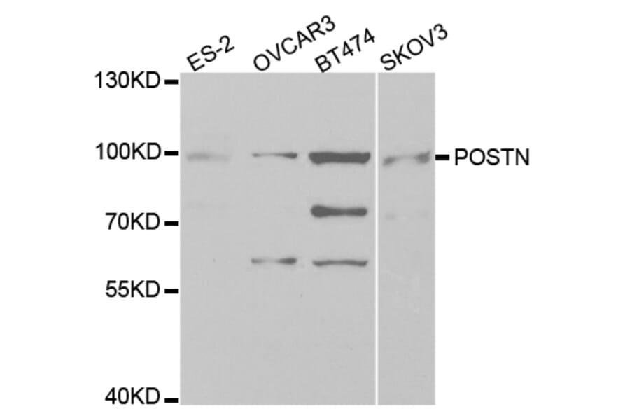 Western blot - POSTN antibody from Signalway Antibody (38331) - Antibodies.com