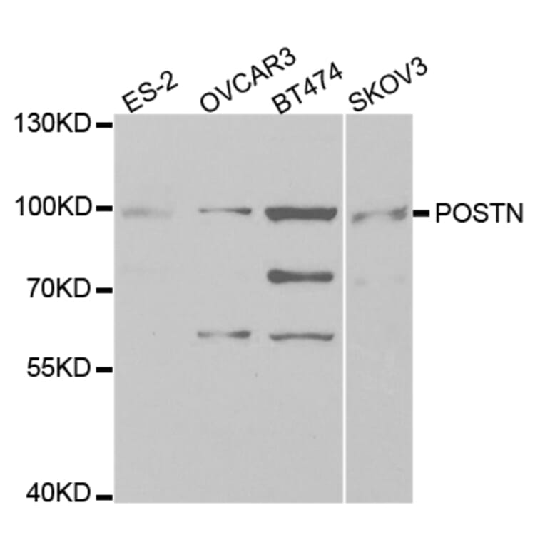 Western blot - POSTN antibody from Signalway Antibody (38331) - Antibodies.com