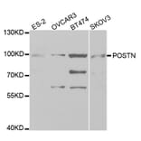 Western blot - POSTN antibody from Signalway Antibody (38331) - Antibodies.com