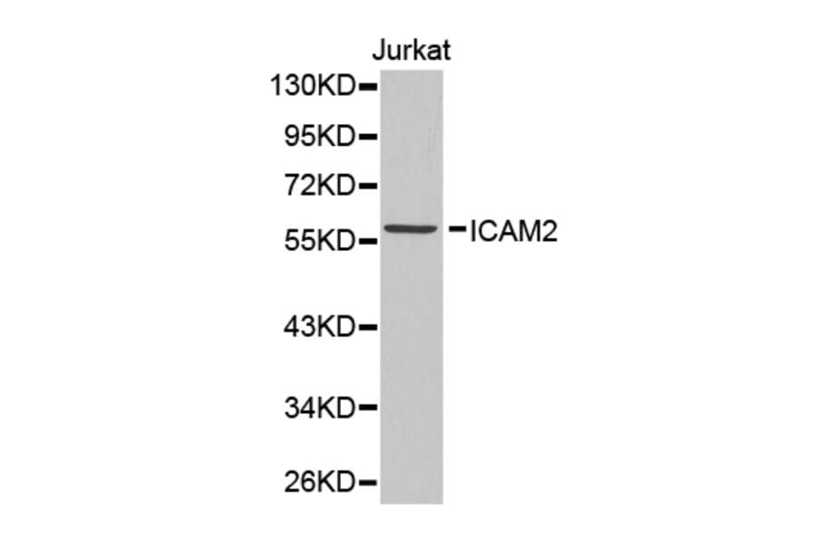 Western blot - ICAM2 antibody from Signalway Antibody (38338) - Antibodies.com