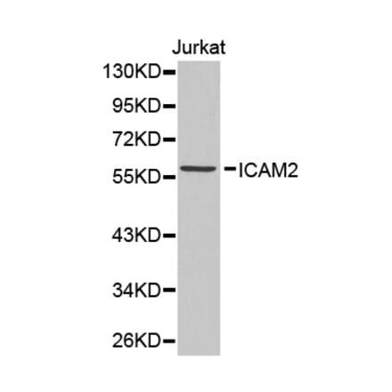 Western blot - ICAM2 antibody from Signalway Antibody (38338) - Antibodies.com
