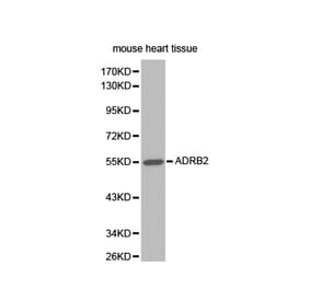 Western blot - ADRB2 antibody from Signalway Antibody (38345) - Antibodies.com