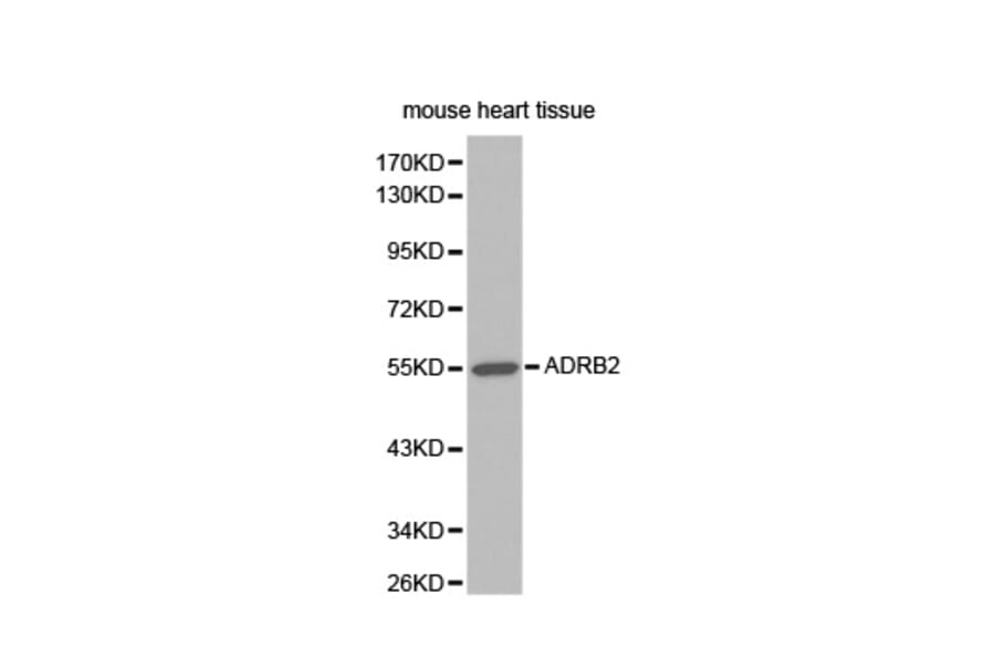 Western blot - ADRB2 antibody from Signalway Antibody (38345) - Antibodies.com