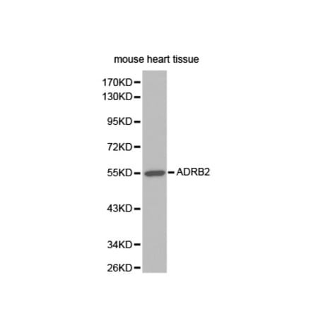 Western blot - ADRB2 antibody from Signalway Antibody (38345) - Antibodies.com