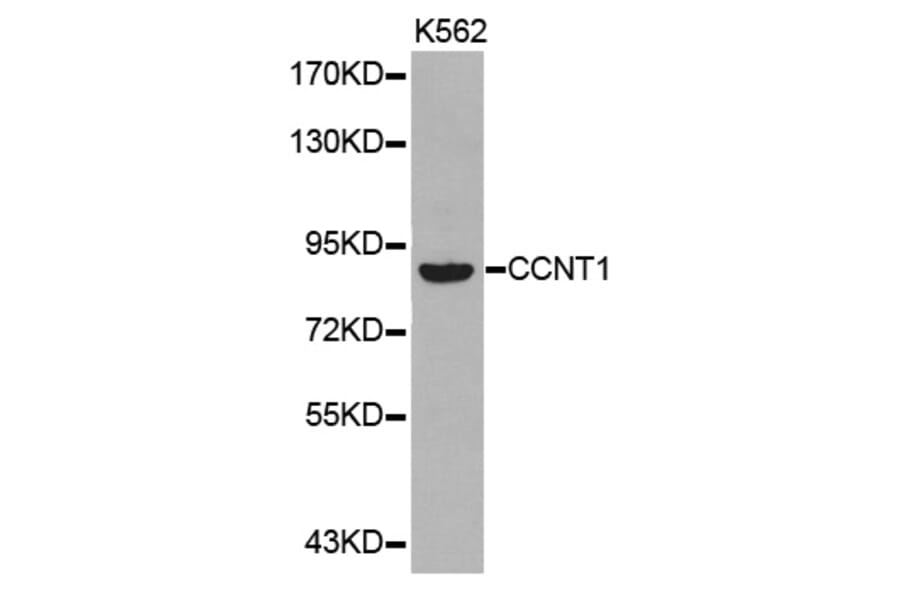 Western blot - CCNT1 antibody from Signalway Antibody (38347) - Antibodies.com