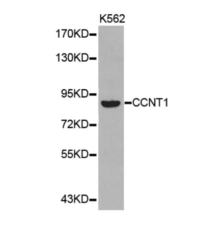 Western blot - CCNT1 antibody from Signalway Antibody (38347) - Antibodies.com