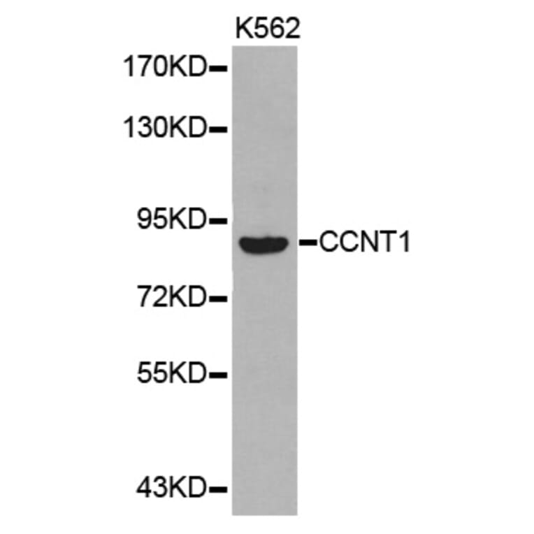 Western blot - CCNT1 antibody from Signalway Antibody (38347) - Antibodies.com