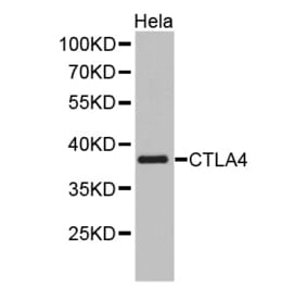 Western blot - CTLA4 antibody from Signalway Antibody (38349) - Antibodies.com