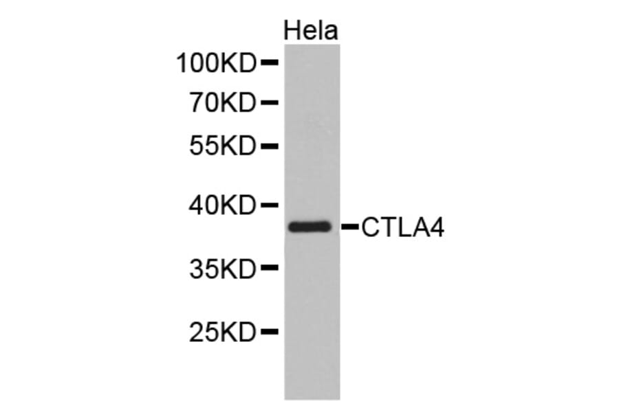 Western blot - CTLA4 antibody from Signalway Antibody (38349) - Antibodies.com