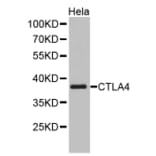Western blot - CTLA4 antibody from Signalway Antibody (38349) - Antibodies.com