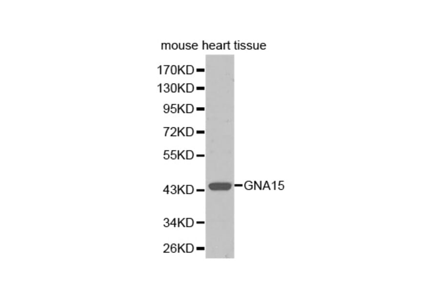 Western blot - GNA15 antibody from Signalway Antibody (38352) - Antibodies.com