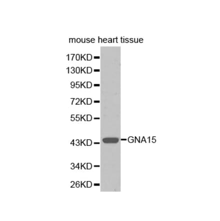 Western blot - GNA15 antibody from Signalway Antibody (38352) - Antibodies.com