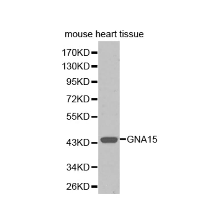 Western blot - GNA15 antibody from Signalway Antibody (38352) - Antibodies.com